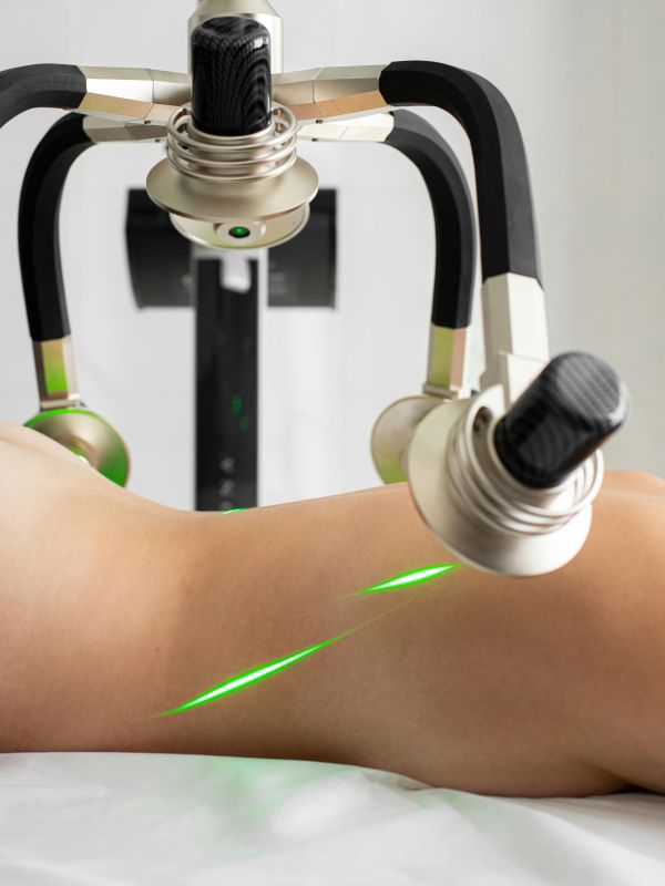 Découvrez le meilleur centre laser à lyon pour vos soins esthétiques